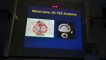 Hở van 2 lá | TS. BS. Nguyễn Tuấn Vũ