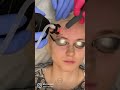 This Combination Laser Treatment Promotes Healthier Skin!