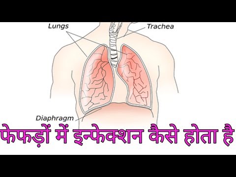 वीडियो: बिल्लियों में फेफड़ों का फंगल संक्रमण (न्यूमोसिस्टोसिस)