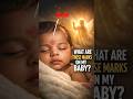 What are red birthmarks on baby eyelids and forehead? -Angel Kisses!
