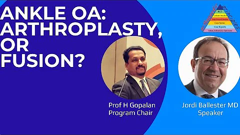 Ankle OA: Fusion or Arthroplasty?