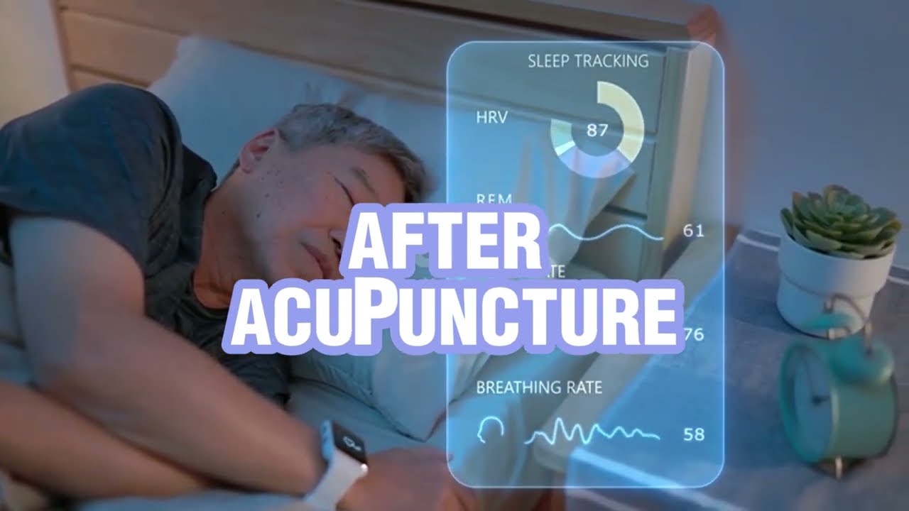Peace Finder Acupuncture Clinic can improve your sleep and overall well-being 