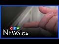 Researchers Develop A Painless Diabetes Patch Researchers Develop A Painless Diabetes Patch