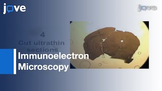 Preparation Of Mouse Brain Tissue For Immunoelectron Microscopy l Protocol Preview