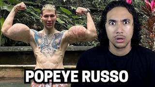 O Russo Bizarro Que Injetou Óleo Nos Braços (E Muito Mais...)