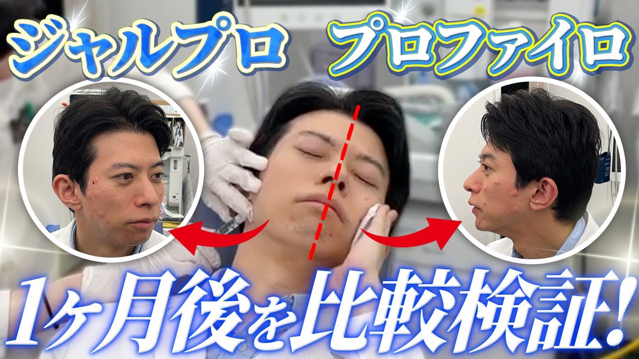 今注目の肌育注射“ジャルプロスーパーハイドロ” vs 小じわ改善の王道“プロファイロ”を半顔ずつ効果を比較しました！【アンチエイジング】