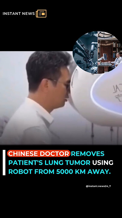 CHINESE DOCTOR REMOVES PATIENT'S LUNG TUMOR USING ROBOT FROM 3,000 MILES AWAY #news