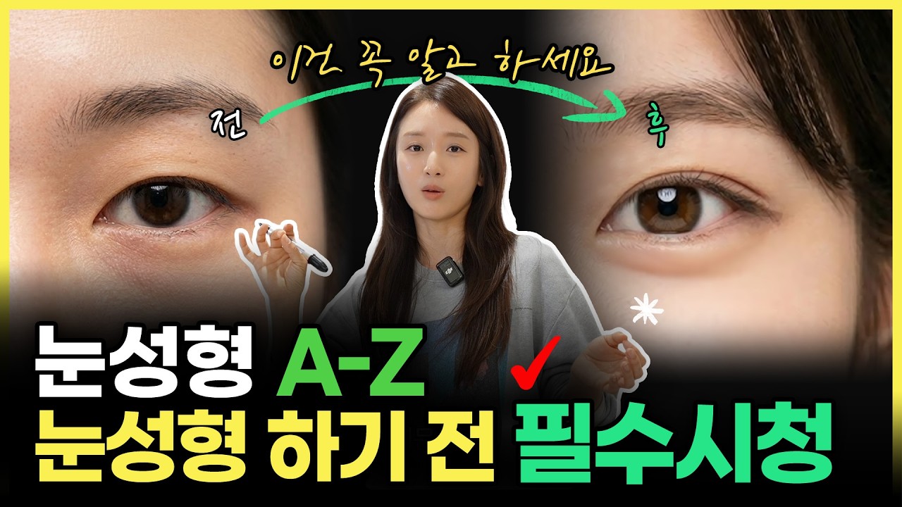 눈성형 하기 전 필수시청