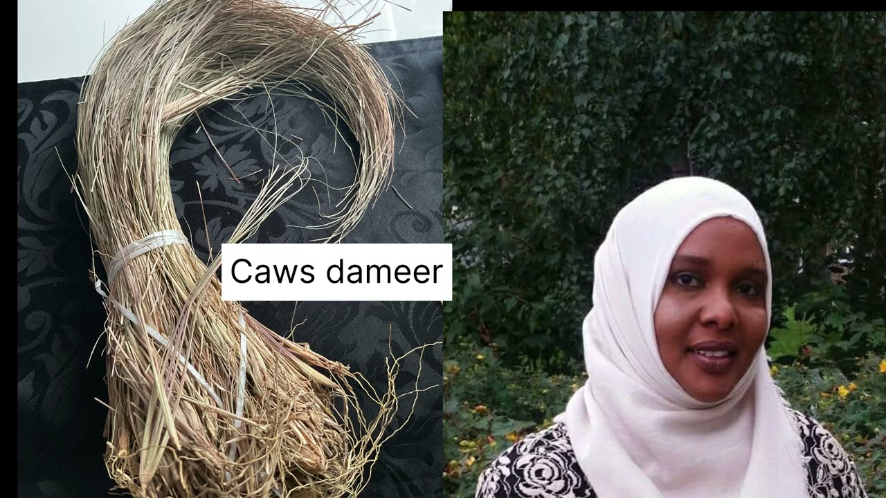 GEDKAN WAXU DAWO U YAHAY KELYO XANUNKA IYO INFECTION KA HOSTAKU DHACA, ILAAHAY DAWO HAYNO SAARO AMIM