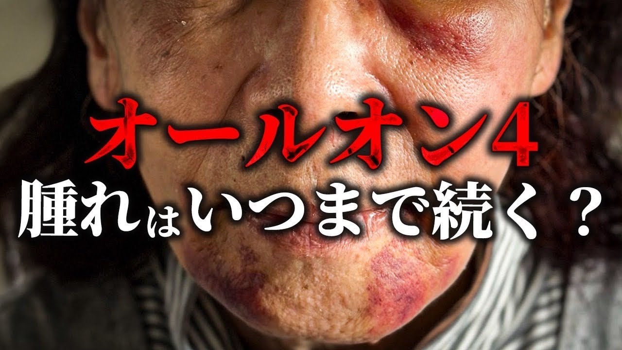 痛くて仕事ができない？オールオン治療直後の未来を徹底解説