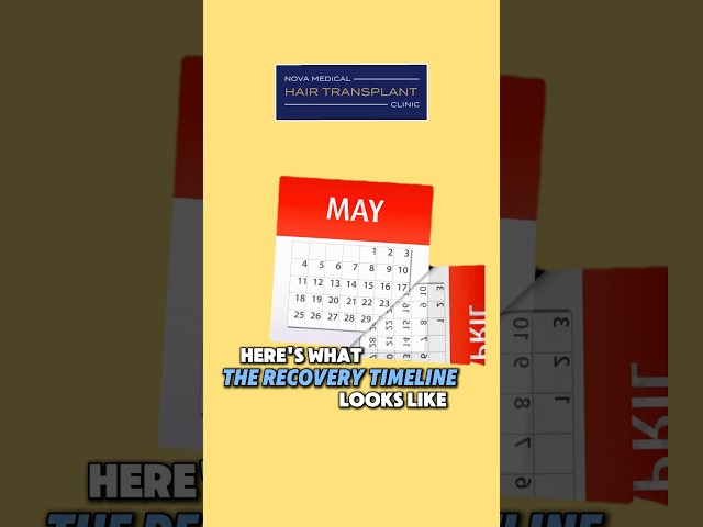 ⏱️What Actually Happens After a Hair Transplant / #hairtransplantrecovery #novahairrestoration