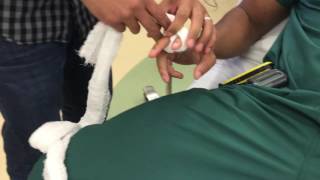Trick of the Trade: Creating finger traps using a gauze roll
