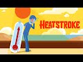 What are early signs of heat stroke? How to treat heat stroke? How to avoid heatstroke?