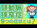 【脳梗塞の原因】頸動脈プラークの症状や検査方法・治療法について解説!【現役医師監修】