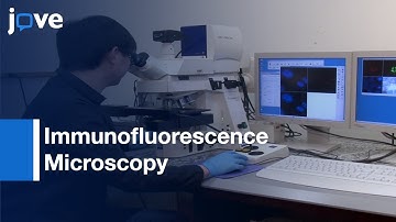 Immunofluorescence Microscopy to Characterize DNA repair Processes | Protocol Preview