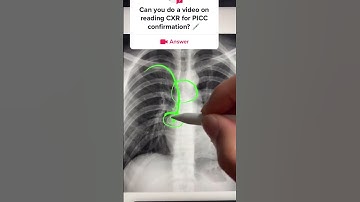 animation - xray cvc tip location.mp4