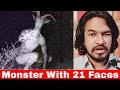 Monster with 21 Faces Mystery | Tamil | Madan Gowri | MG