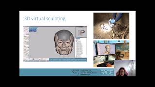 Digital Facial Reconstruction process using Geomagic® Freeform®