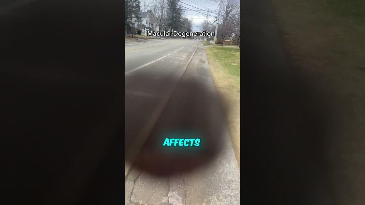 This Is What Blind People Actually See😮