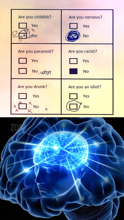 Download lagu Bro’s brain needs to be studied 💀