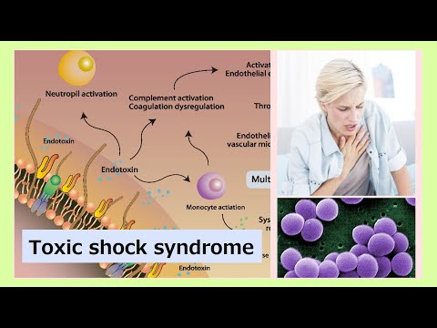 Toxic Shock Syndrome