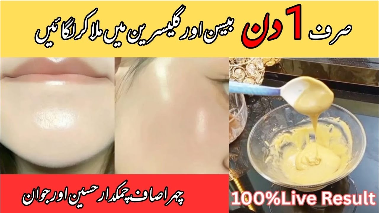 Instant Hand Whitening Home Remedy|Whitening Cream|How to Whiten Dark Hands in Winter Fast 