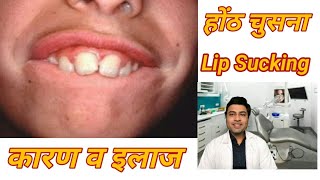 Lip Sucking - Lip Biting habit - होंठ चुसना - causes and cures - Dr. Pranay Thakkar in Hindi