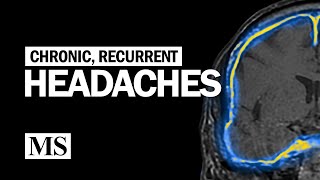 Recurrent and Chronic Headaches by The Neurophile (by Rutgers RWJMS Neurology) 31,630 views 2 years ago 51 minutes