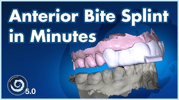 BSPV5.0 Design an Anterior Bite Splint in Minutes — Full Digital Workflow