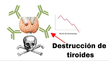 ¿Cuál es la causa principal de la hipotiroidismo?