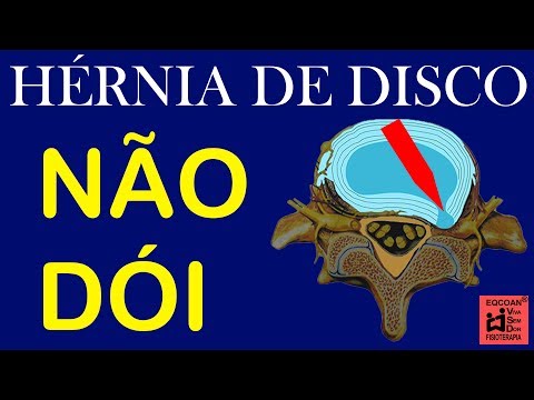 artrose no joelho Entenda porque só depois de sentir dor você descobre que já tem uma hérnia de disco