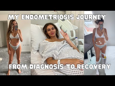 My Endometriosis Journey