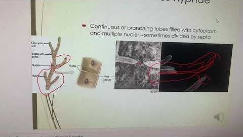 Skipping audio in PowerPoint.