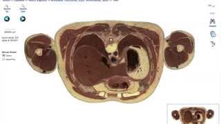 The Body in Cross Sections