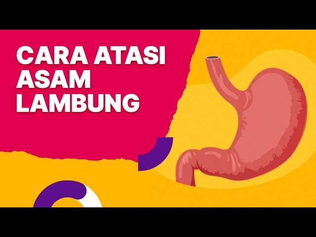 Cara Tepat Mengatasi Asam Lambung class=