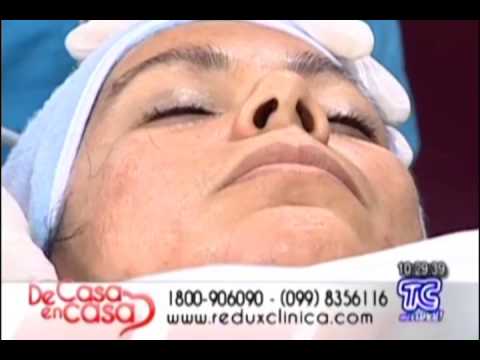 Electroporacion Facial