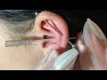 close up conch piercing at home