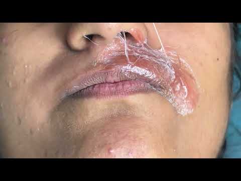 Full growth upperlips waxing / #upperlipswaxing #hardwax #skincare #brazillianwax @pummybeautyworld 