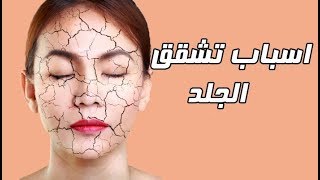 اسباب تشقق الجلد ونصائح لعلاج هذا التشققات