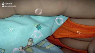 Cleavage Ng Baby Koh