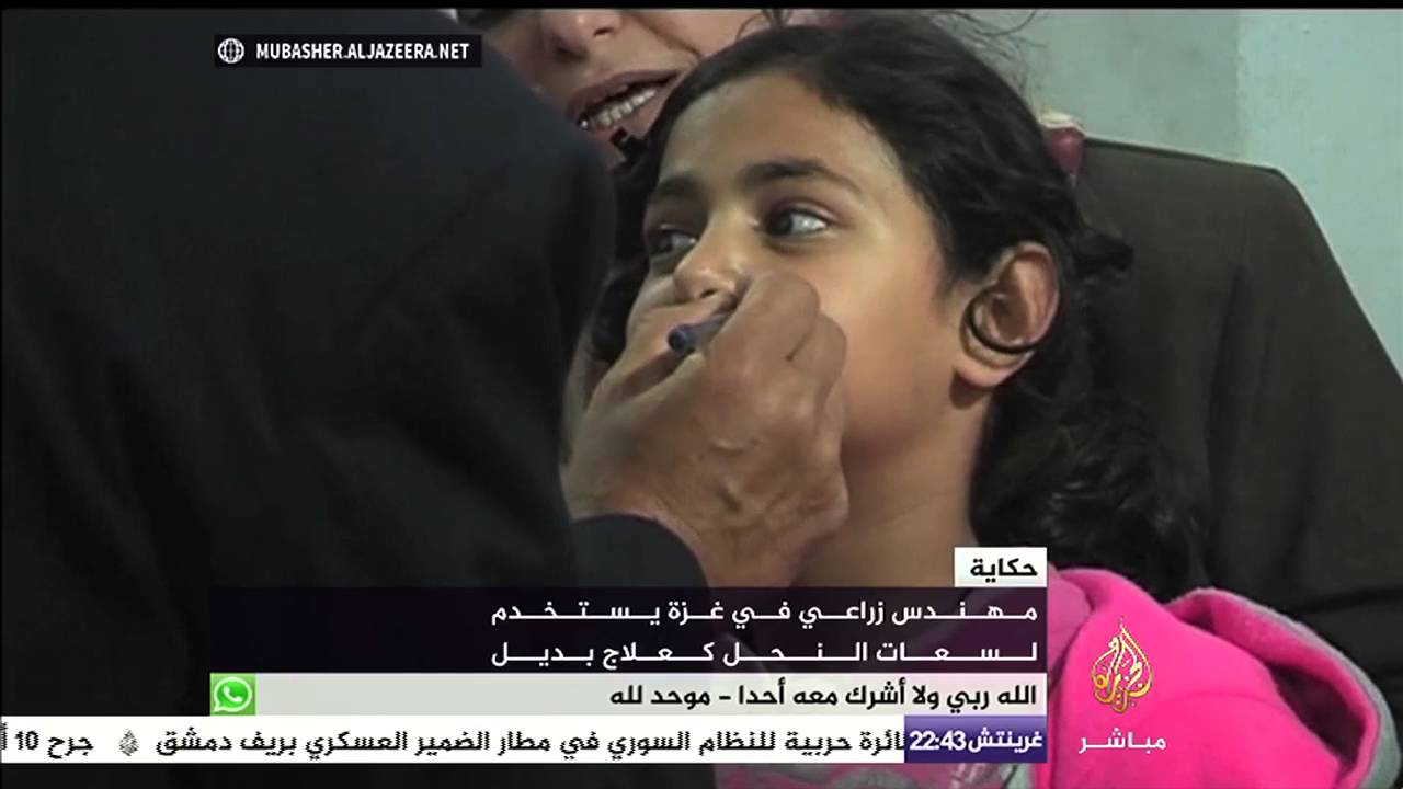 حكاية .. مهندس زراعي في غزة يستخدم لسعات النحل كعلاج بديل