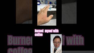 Famous Coffee Burn First Aid:  Aloe Vera & Antibiotic Ointment Recommended Net Worth