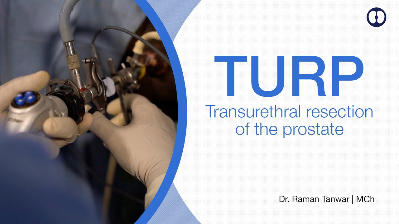 Turp Holep Prostate Surgery Kya Hai Aur Kab Ki Jaati Hai Thulium Laser Prostate Surgery