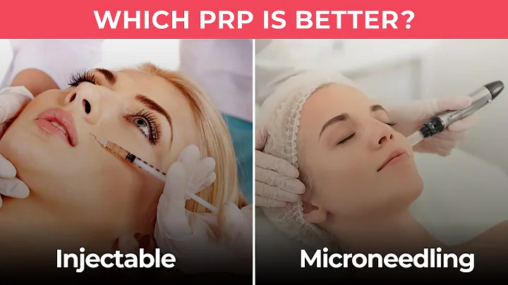 Injectable PRP vs Microneedling PRP - Which PRP is Better?