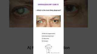 Answer in comment please👉👉#usmle#plab1#fcps#mbbs #quiz#shorts