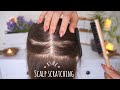 [ASMR] Scalp scratching with nails and brush | Sleep Therapy | Heals Your Anxiety | No Talking