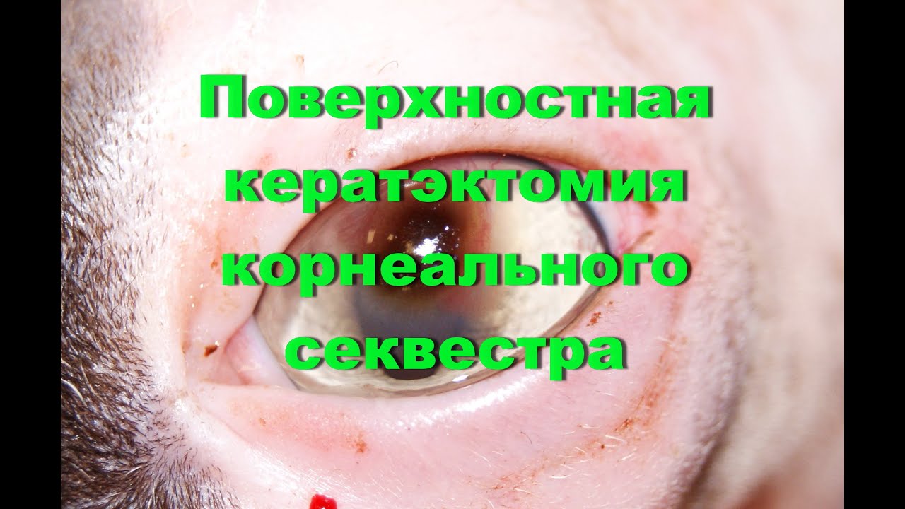 Передняя поверхностная кератэктомия корнеального секвестра у кошки ...