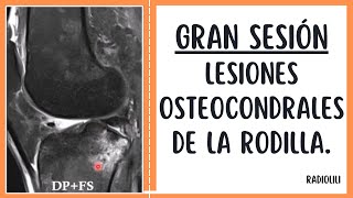 Gran Sesión 2: Lesiones Osteocondrales de la Rodilla.