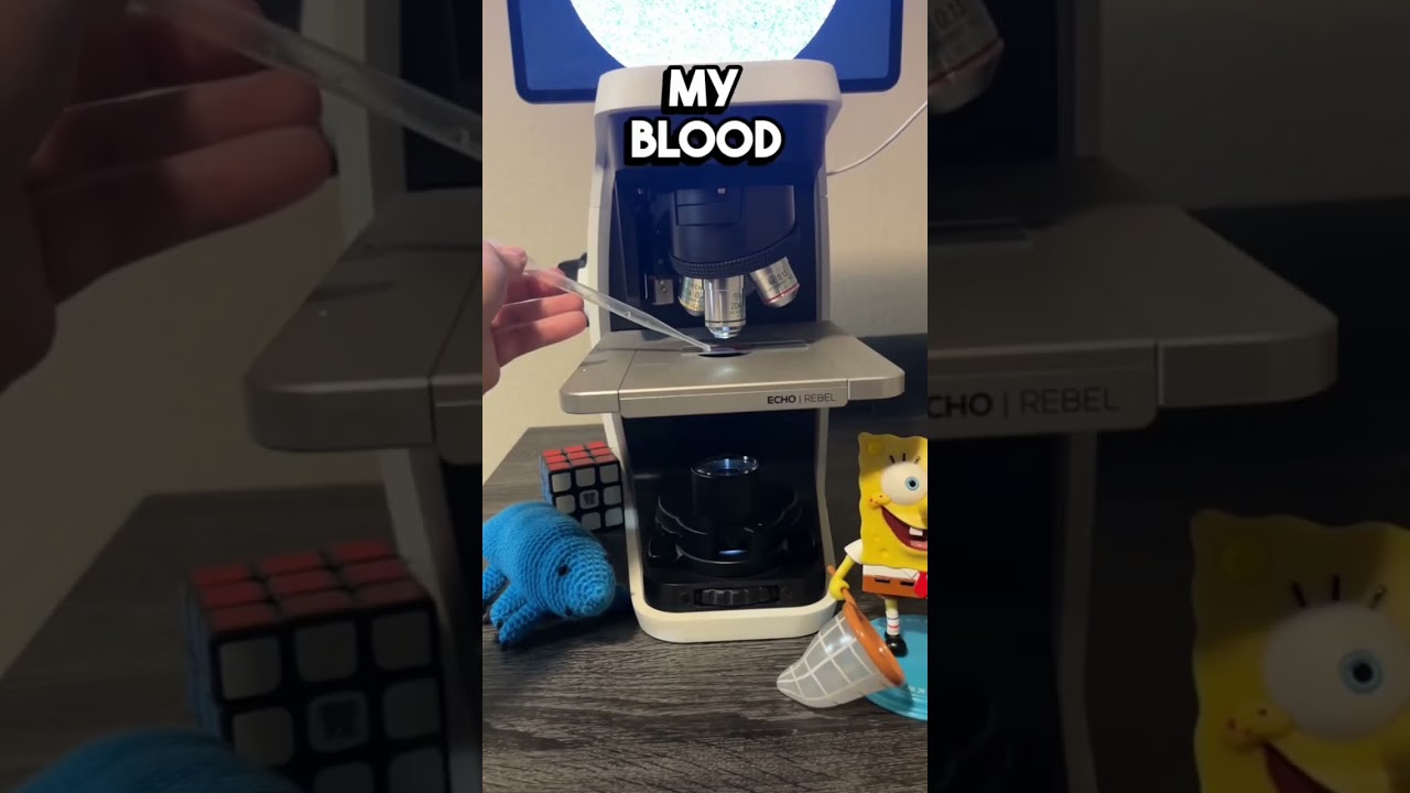 What if you received the wrong blood type?! 