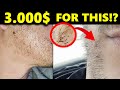 Subscriber&#39;s Beard and Hair Transplant! My Review and What Went Wrong...